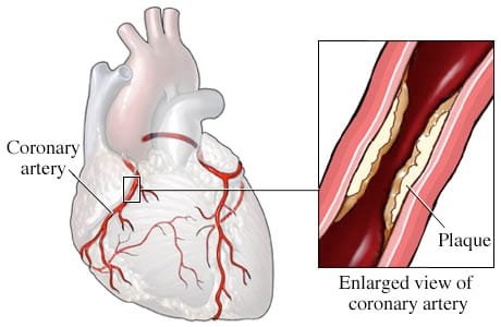 Diet, nutritional and degenerative disease